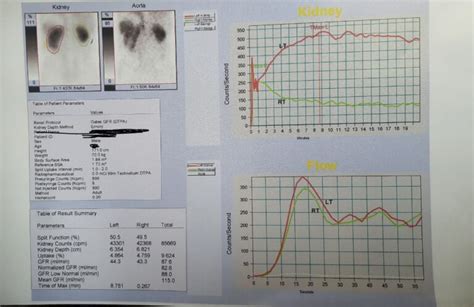 dtpa renal scan results interpretation